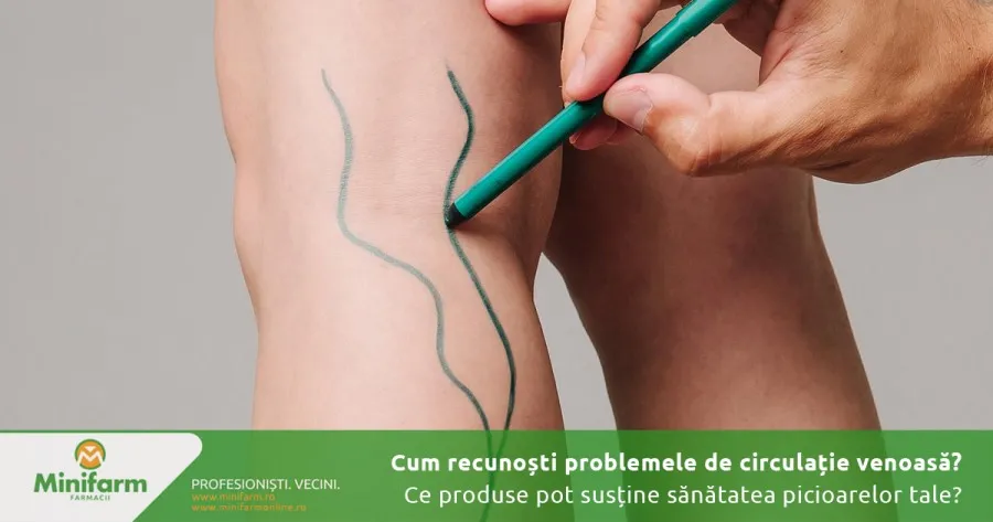 Produse pentru varice și circulație venoasă – ce trebuie să știi