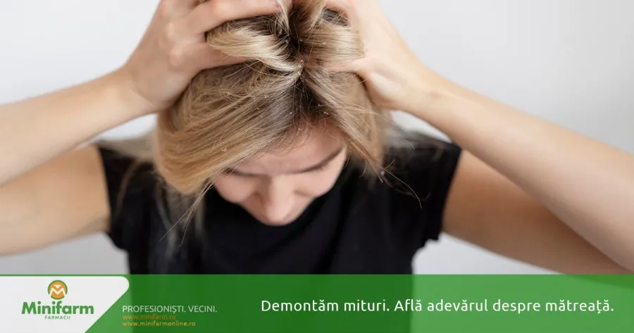 Adevărul despre mătreață: cauze și mituri demontate