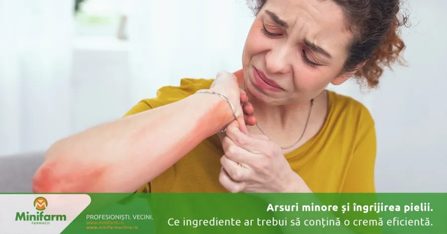 Arsuri minore și îngrijirea pielii: ce ingrediente ar trebui să conțină o cremă eficientă pentru calmare și regenerare