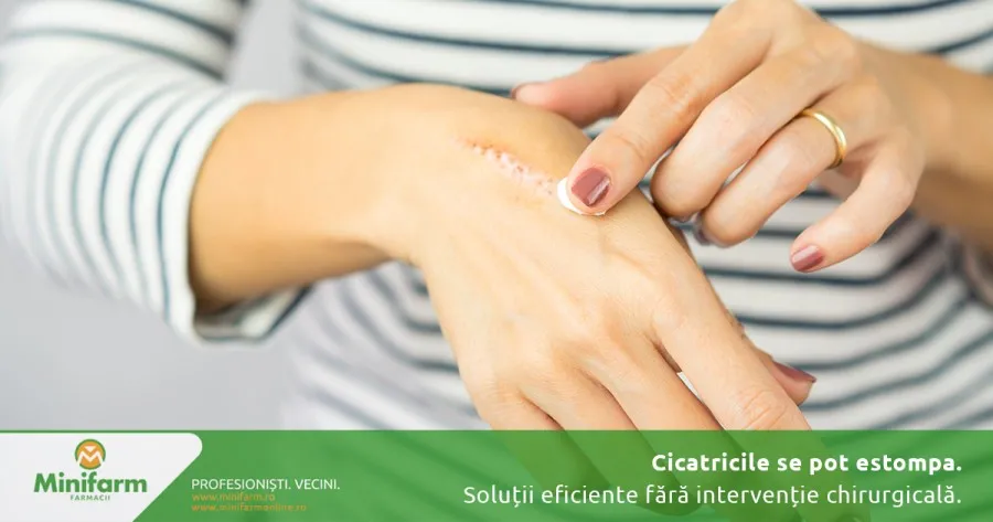 Cicatricile se pot estompa: soluții eficiente fără intervenție chirurgicală