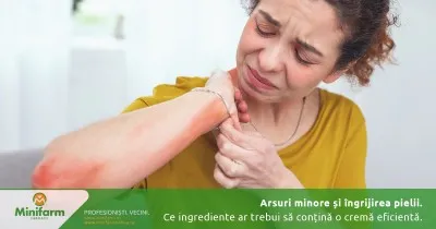 Arsuri minore și îngrijirea pielii: ce ingrediente ar trebui să conțină o cremă eficientă pentru calmare și regenerare