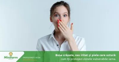 Buze crăpate, nas iritat și piele care ustură: cum îți protejezi zonele vulnerabile iarna