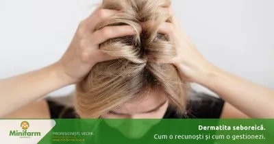 Când mătreața nu este doar o problemă estetică: cum recunoști și gestionezi dermatita seboreică
