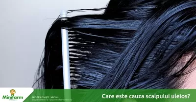 Care este cauza scalpului uleios?