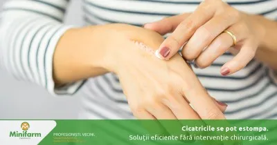 Cicatricile se pot estompa: soluții eficiente fără intervenție chirurgicală