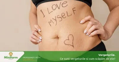 Vergeturile – de ce apar și ce trebuie să știm despre ele