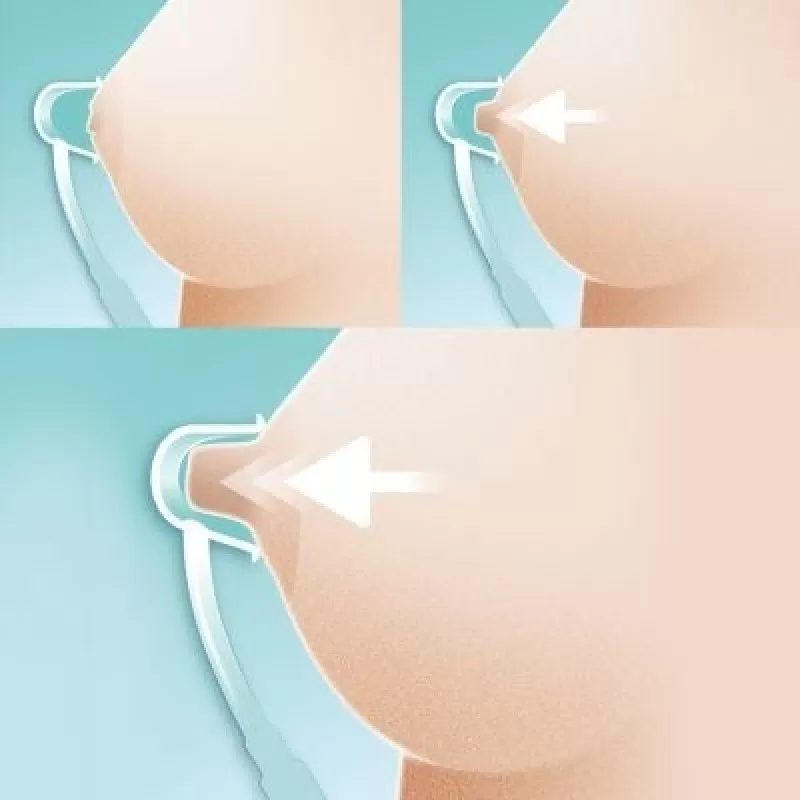 Corector San Niplette 152/01, Avent Philips