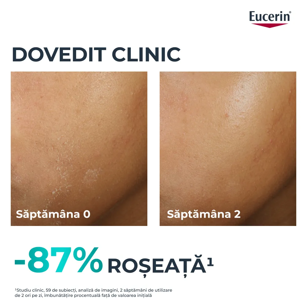 Fluid Hidratant de Fata DermoPure, 40ml, Eucerin