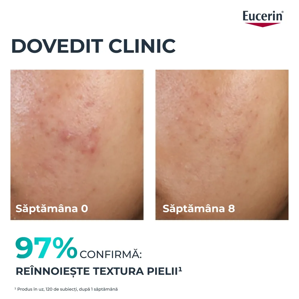 Tratament Exfoliant pt Noapte DermoPure, 40ml, Eucerin