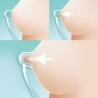 Corector San Niplette 152/01, Avent Philips