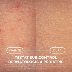 Balsam anti-prurit pentru piele foarte uscata si cu tendinta atopica, Atoderm AD Intensive , 400ml, Bioderma