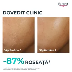 Fluid Hidratant de Fata DermoPure, 40ml, Eucerin