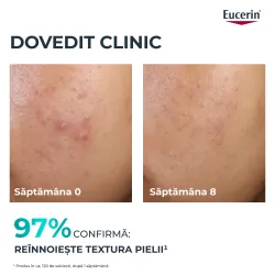 Tratament Exfoliant pt Noapte DermoPure, 40ml, Eucerin